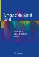 [PDF]Tumors of the Spinal Canal