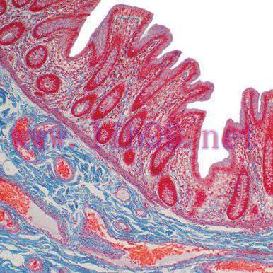 [AME]Current Topics in Gastrointestinal and Liver Pathology 2022 (CME VIDEOS)