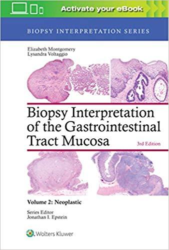 Biopsy Interpretation of the Gastrointestinal Tract Mucosa Volume 2 Neoplastic Third Edition