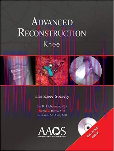 [PDF]Adcanced Reconstruction - Knee