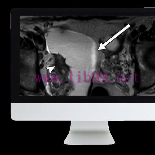 [AME]ARRS Women's Imaging 2019 (CME VIDEOS)