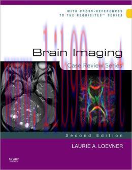 [AME]Brain Imaging: Case Review Series, 2nd Edition (ORIGINAL PDF from_ Publisher)