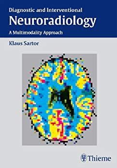 Diagnostic and Interventional Neuroradiology, 1e [Thieme] [2002]