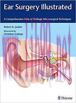 (PDF)Ear Surgery Illustrated: A Comprehensive Atlas of Otologic Microsurgical Techniques 1st Ed...