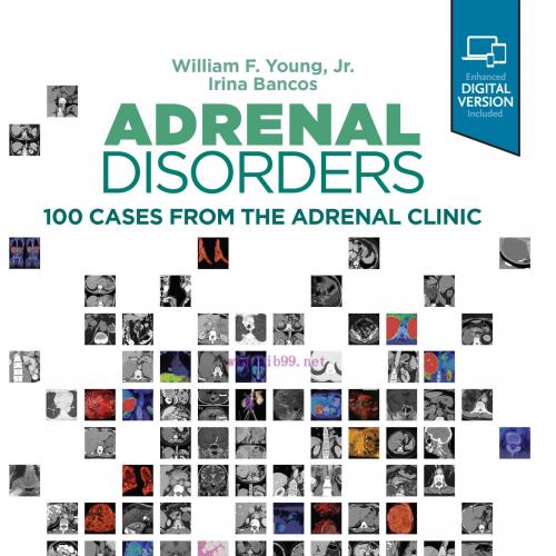 [AME]Adrenal Disorders: Cases from_ the Adrenal Clinic (EPUB)
