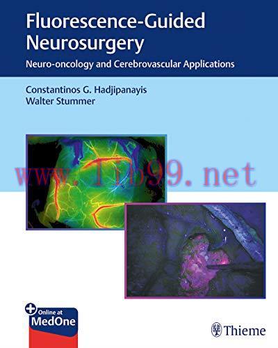[AME]Fluorescence-Guided Neurosurgery: Neuro-oncology and Cerebrovascular Applications (PDF+Vid...