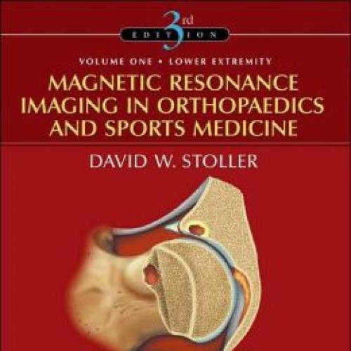 Magnetic Resonance Imaging in Orthopaedics and Sports Medicine 3e,2-Volume set