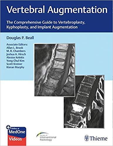 Vertebral Augmentation The Comprehensive Guide to Vertebroplasty, Kyphoplasty, and Implant Augm...