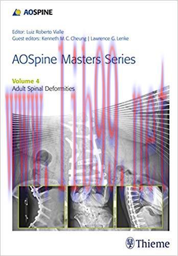 [PDF]AOSpine Masters Series, Volume 4 Adult Spinal Deformities