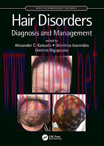 [AME]Hair Disorders: Diagnosis and Management (Series in Dermatological Treatment) (Original PD...