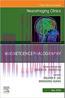 (PDF)Magnetoencephalography,An Issue of Neuroimaging Clinics of North America, E-Book (The Clin...
