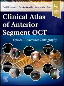 [AME]Clinical Atlas of Anterior Segment OCT: Optical Coherence Tomography (Original PDF)