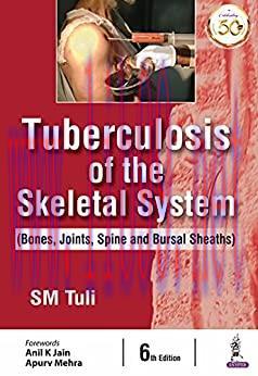 [PDF]Tuberculosis Of The Skeletal System (Bones, Joints, Spine And Bursal Sheaths) 6th Edition
