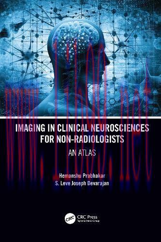 [AME]Imaging in Clinical Neurosciences for Non-radiologists: An Atlas (EPUB)