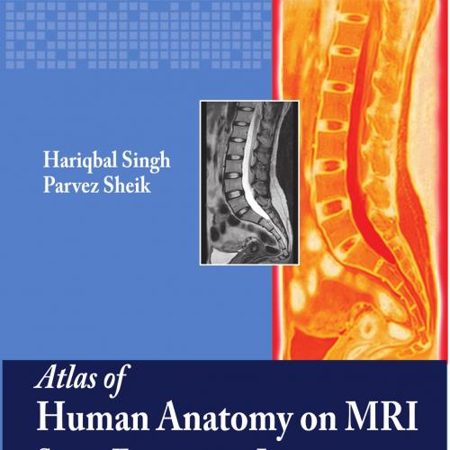Atlas Of Human Anatomy On MRI Spine Extremities Joints - Hariqbal, Singh