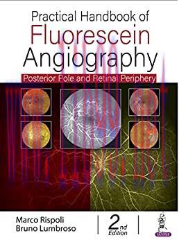 [AME]Practical Handbook of Fluorescein Angiography: Posterior Pole and Retinal Periphery, 2nd E...