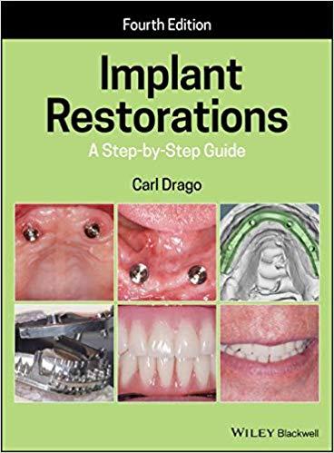 Implant Restorations A Step-by-Step Guide 4th Edition