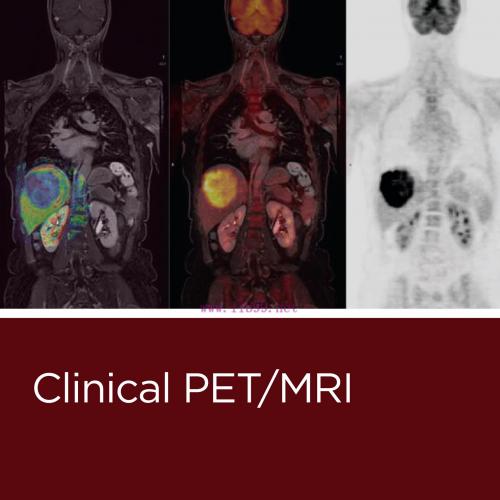 [AME]Clinical PET/MRI (Original PDF)