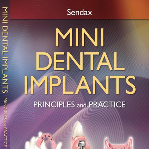 Mini Dental Implants Principles and Practice, 1E (2013)