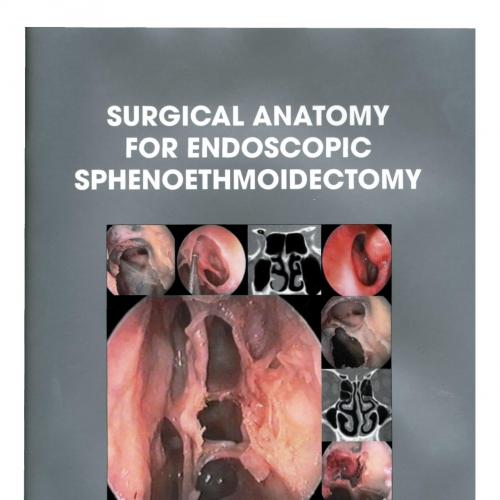 surgical anatomy for endoscopic sphenoethmoidectomy