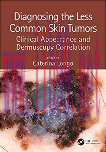 [PDF]Diagnosing the Less Common Skin Tumors