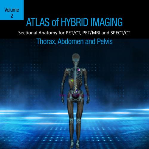 [AME]Atlas of Hybrid Imaging Sectional Anatomy for PET/CT, PET/MRI and SPECT/CT Vol. 2: Thorax ...