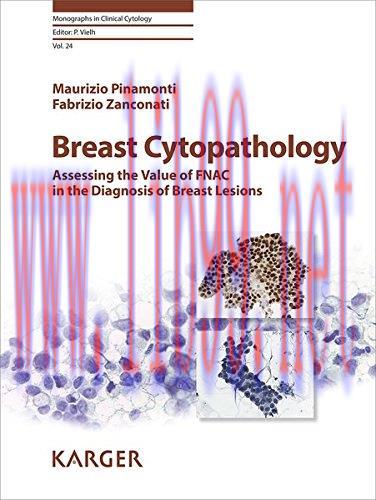 [AME]Breast Cytopathology: Assessing the Value of FNAC in the Diagnosis of Breast Lesions (Mono...