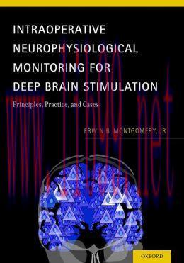 [AME]Intraoperative Neurophysiological Monitoring for Deep Brain Stimulation: Principles, Pract...