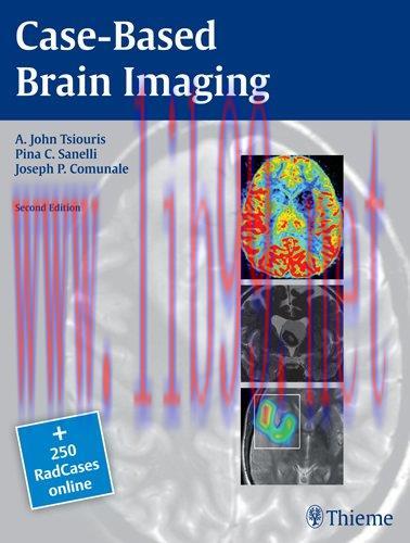 [AME]Case-Based Brain Imaging 2nd Edition (Original PDF)