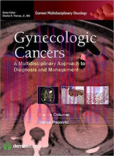 [PDF]Gynecologic Cancers: A Multidisciplinary Approach to Diagnosis and Management