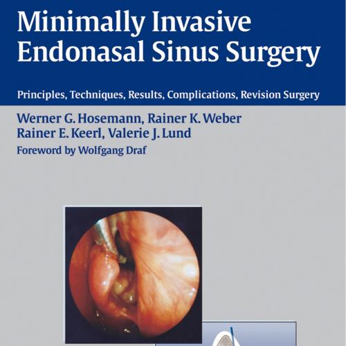 Minimally Invasive Endonasal Sinus Surgery Principles, Techniques, Results, Complications, Revi...