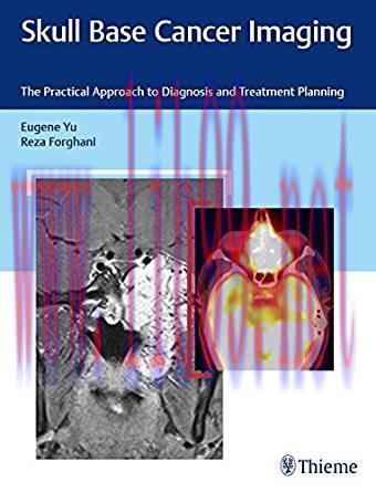 [PDF]Skull Base Cancer Imaging - The Practical Approach to Diagnosis and Treatment