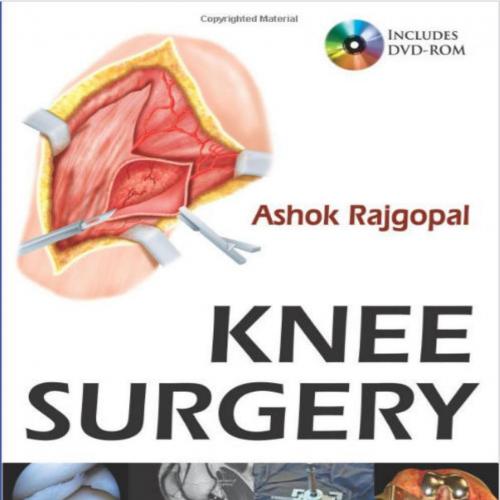 Knee Surgery
