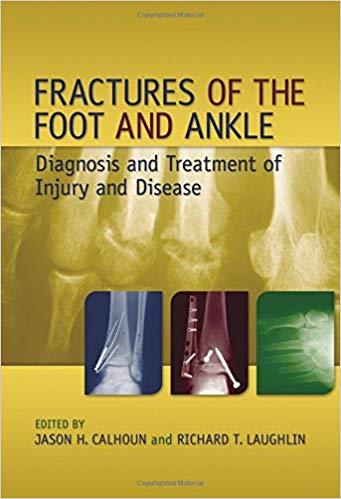 Fractures of Foot and Ankle