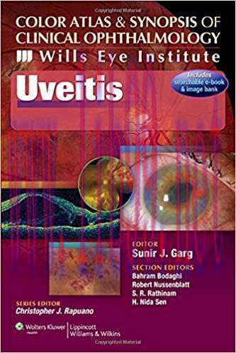 [EPUB]Uveitis (Color Atlas and Synopsis of Clinical Ophthalmology)