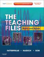 [PDF]The Teaching Files: Brain and Spine