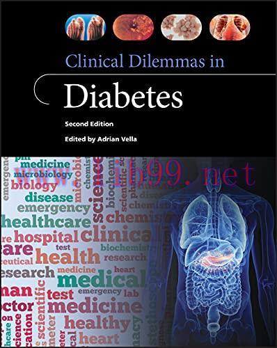 [AME]Clinical Dilemmas in Diabetes, 2nd Edition (Original PDF)