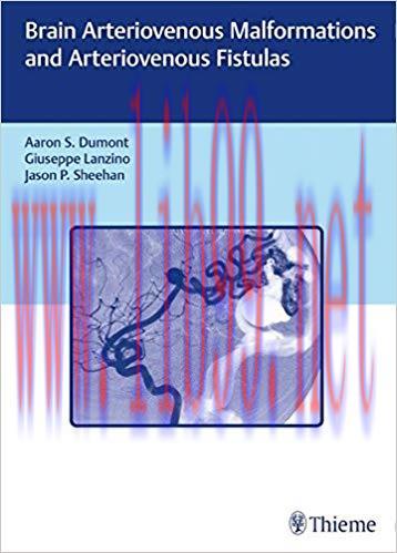 [PDF]Brain Arteriovenous Malformations and Arteriovenous Fistulas