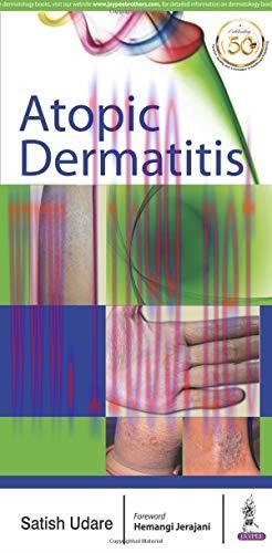 [AME]Atopic Dermatitis (Original PDF)