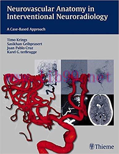 [PDF]Neurovascular Anatomy in Interventional Neuroradiology