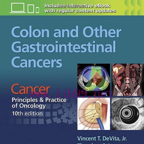 [AME]Colon and Other Gastrointestinal Cancers: Cancer: Principles & Practice of Oncology, 10th ...