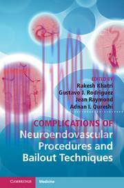 [AME]Complications of Neuroendovascular Procedures and Bailout Techniques (Retail PDF)