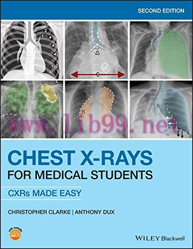 [AME]Chest X-Rays for Medical Students: CXRs Made Easy, 2nd Edition