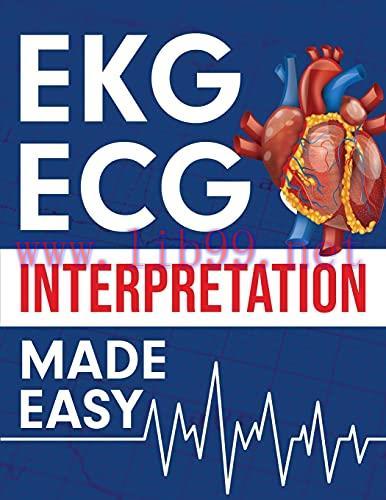 [AME]EKG | ECG Interpretation Made Easy: An Illustrated Study Guide For Students To Easily Lear...
