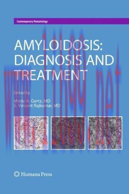 [AME]Amyloidosis: Diagnosis and Treatment (Original PDF)