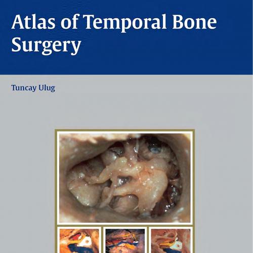 Atlas of Temporal Bone Surgery