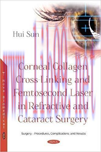 [PDF]Corneal Collagen Cross-linking and Femtosecond Laser in Refractive and Cataract Surgery
