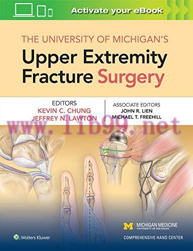 [AME]The University of Michigan's Upper Extremity Fracture Surgery (EPUB)