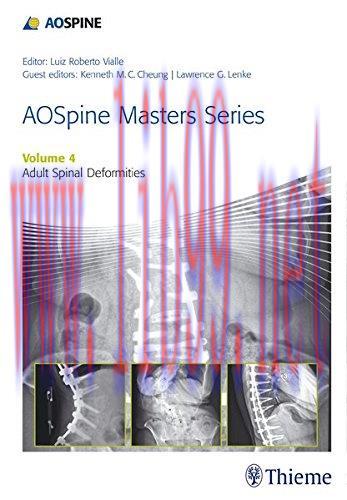 [AME]AOSpine Master Series, Vol. 4: Adult Spinal Deformities (AOSpine Masters Series) (PDF)