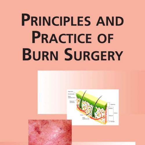 Principles and Practice of Burn Surgery